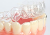 Clínica Dental Poniente Ortodoncia 5